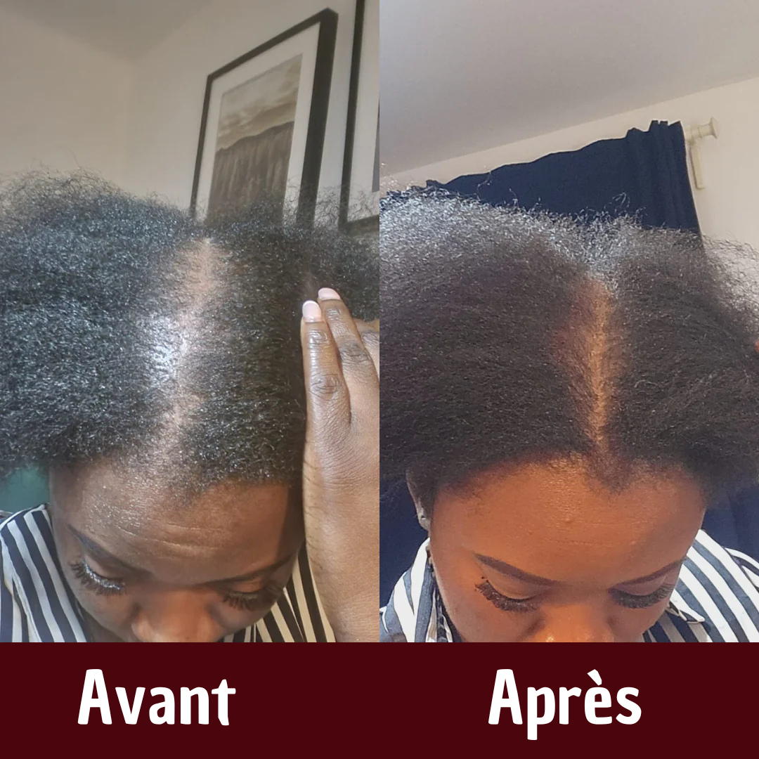 APRES